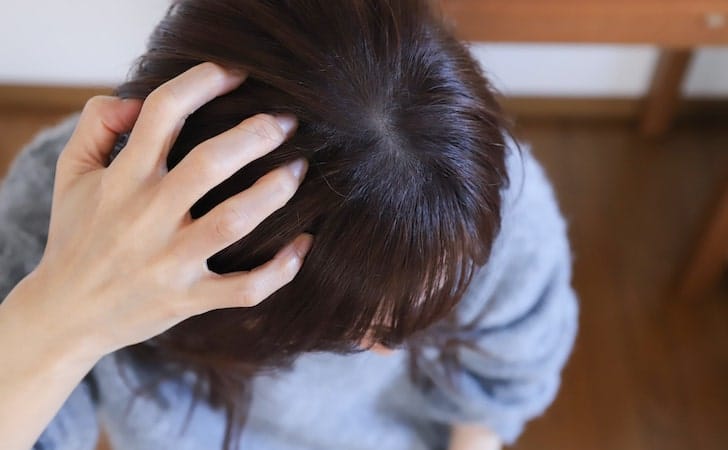 頭皮の毛穴詰まりは肌トラブルを引き起こす！原因と改善策を徹底解説